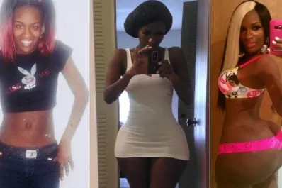 Adicta a la silicona ya gastó más de u$s 15.000 en inyecciones para su cola