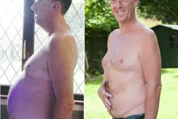 ANTES Y DESPUES. Un gran alivio sintió Jeff. FOTO TOMADA DE THESUN.CO.UK