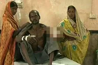 Un jefe le cortó la mano a su empleado por pedir el sueldo atrasado