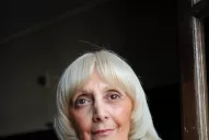 La operaron de presbicia y catarata, recuperó la visión y le dijo chau a los anteojos y la lupa