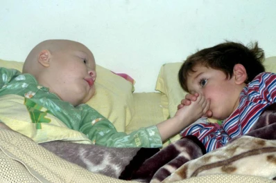 Un nene de tres años salvó la vida a su hermanito de cuatro con un trasplante de médula ósea