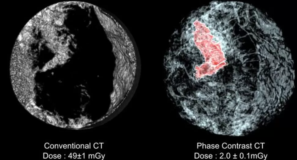 DESAFIO FUTURO. El diagnóstico en 3D estará disponible para los pacientes FOTO TOMADA DE PNAS.ORG