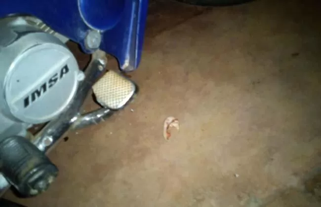 A LO TYSON. Un sujeto le arrancó de un mordisco el pabellón auricular a otro. FOTO TOMADA DE MISIONESONLINE.NET