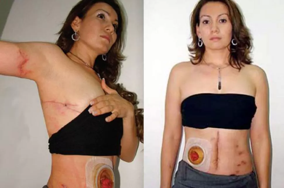 DURAS MARCAS. La ex alcaldesa ya había sufrido dos ataques previos. FOTO TOMA DE MX-NEWS.COM Y FREUDENELPARQUEMEXICO.BLOGSPOT.COM