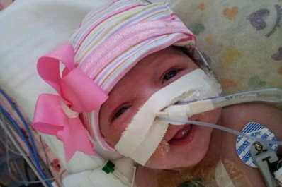 Nació con el corazón fuera del cuerpo y sobrevivió