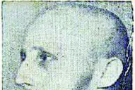 Antes era una cirugía mutilante