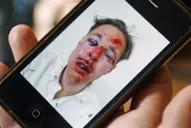 Una víctima de un ataque homófobo en Francia muestra las consecuencias en Facebook