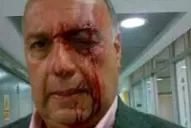 Chavistas agreden brutalmente a diputados opositores