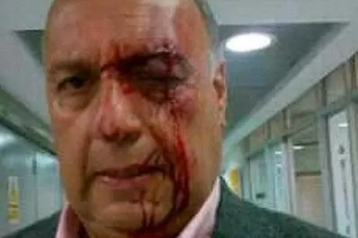 Chavistas agreden brutalmente a diputados opositores