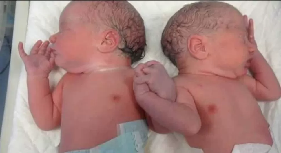 UNIDOS EN SERIO. Los mellizos se toman de la mano, instantes después de salir del vientre de su madre. FOTO TOMADA DE LAVANGUARDIA.COM