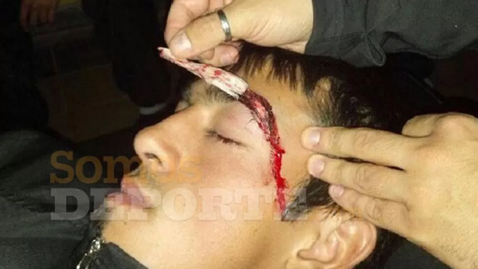 HERIDO. Federico Vega, uno de los jugadores agredidos. FOTO TOMADA DE DIARIOPANORAMA.COM