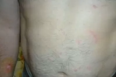 Caso Ángeles Rawson: revelan imágenes de las heridas que mostró el portero