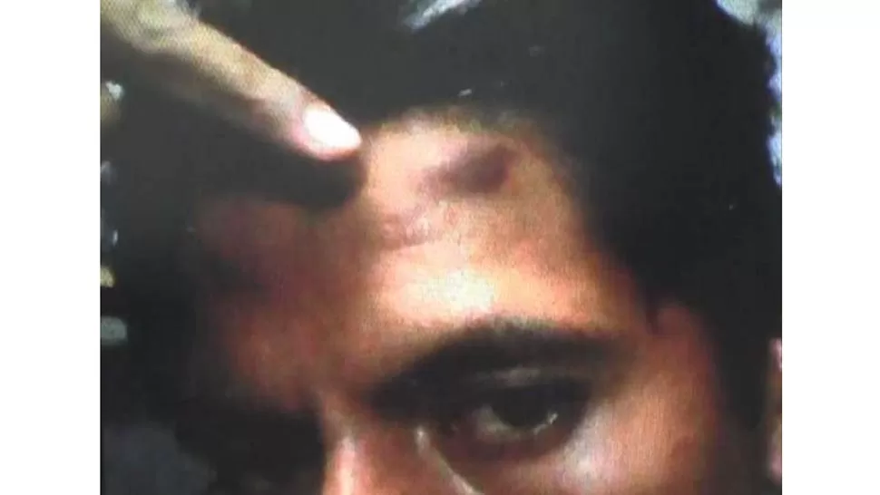 APREMIOS. Velázquez asegura que lo golpearon. FOTO TOMADA DE ELTRIBUNO.INFO