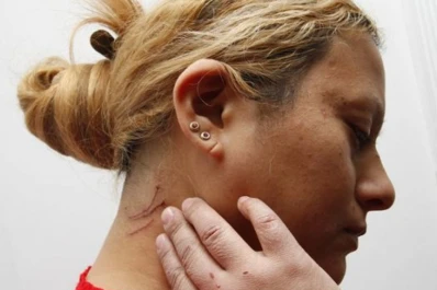 Salta: Dos vecinas la atacaron a zapatazos