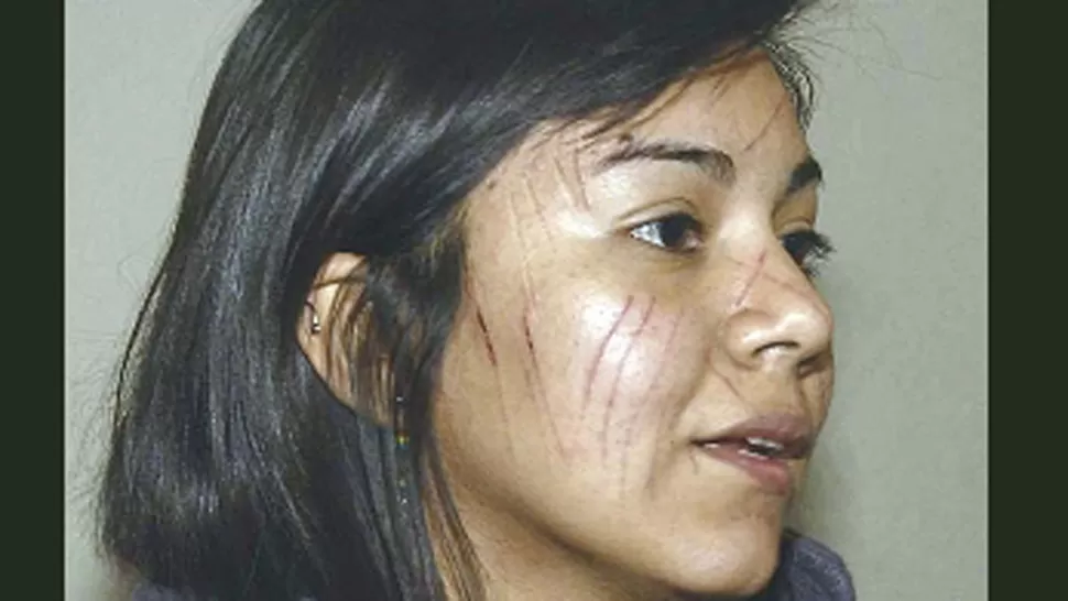 AGREDIDA. Gómez Ponce fue tomada por sorpresa por desconocidos. FOTO DE ELLIBERAL.COM