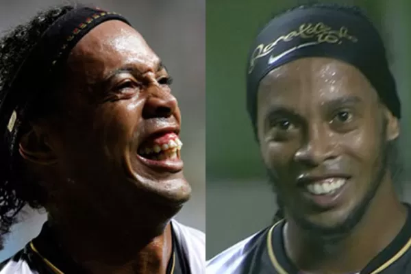 Ronaldinho arregló sus dientes