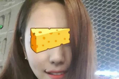 Sonrisa permanente, lo último en cirugías estéticas