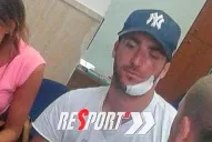 Higuaín sufrió un accidente en un barco y terminó con 10 puntos en la cara