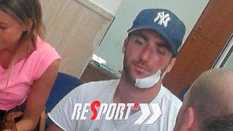 PARCHADO. Así quedó Higuaín tras el accidente. FOTO TOMADA DE 26NOTICIAS.COM.AR