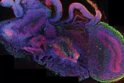 Científicos austríacos y alemanes produjeron minicerebros humanos en laboratorios