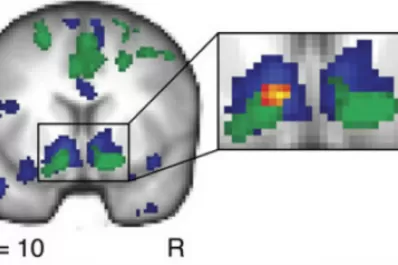 ¿Qué tienen en común Facebook y el sexo?
