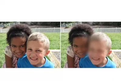 Si tu visión central es borrosa, no dejés pasar el tiempo y consultá al oftalmólogo