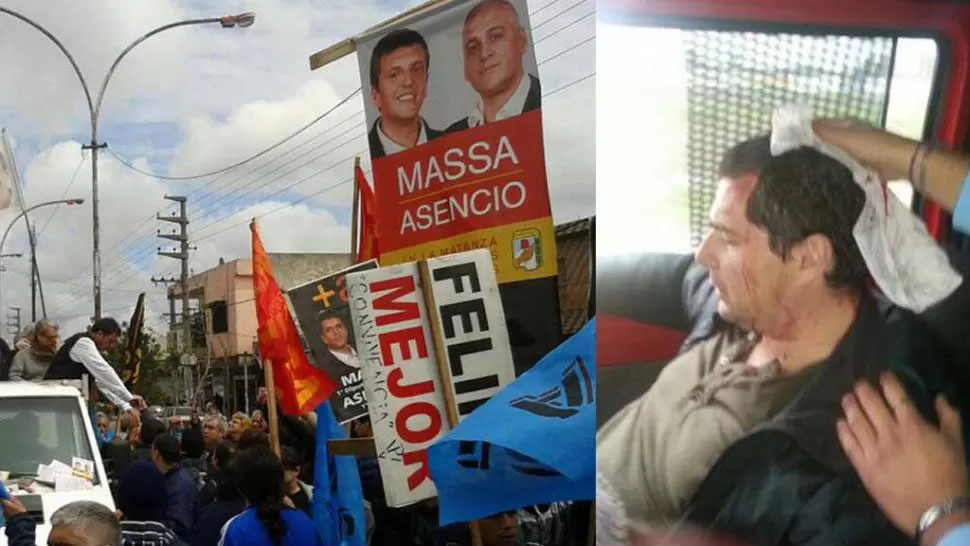 EN LA MATANZA. Uno de los heridos que acompañaban a Sergio Massa. FOTO TOMADA DE TN.COM.AR