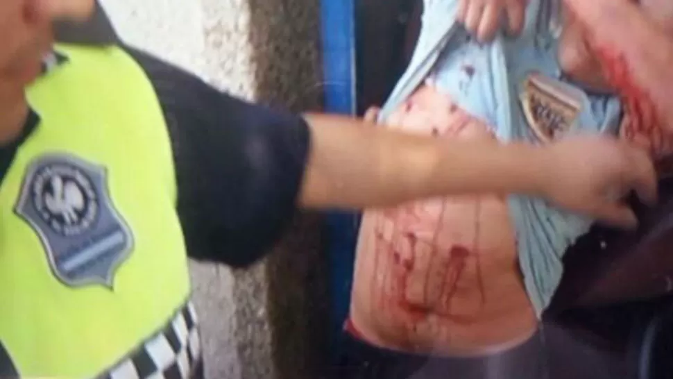 HERIDA. Uno de los detenidos fue llevado al hospial. GENTILEZA ISAÍAS CISNEROS
