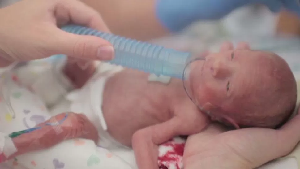 BEBÉ PREMATURO. El video es enternecedor. FOTO TOMADA DE CNNESPANOL.CNN.COM