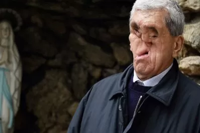 Así vive el hombre sin rostro Oreste Tornani que saludó al Papa