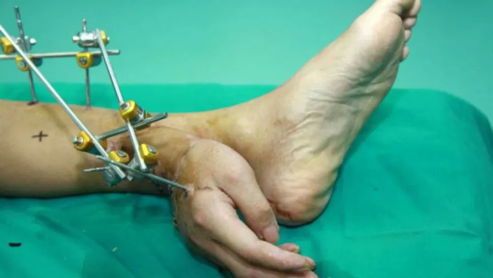 ASí QUEDÓ. El hombre tuvo su mano en el tobillo. IMAGEN TOMADA DE METRO.CO.UK