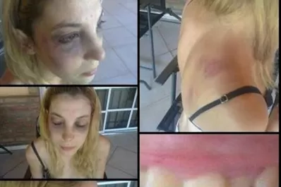 Su ex pareja la molió a golpes y ella lo escrachó en Facebook