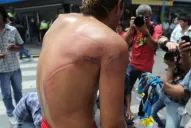 La protesta de ambulantes dejó 18 detenidos