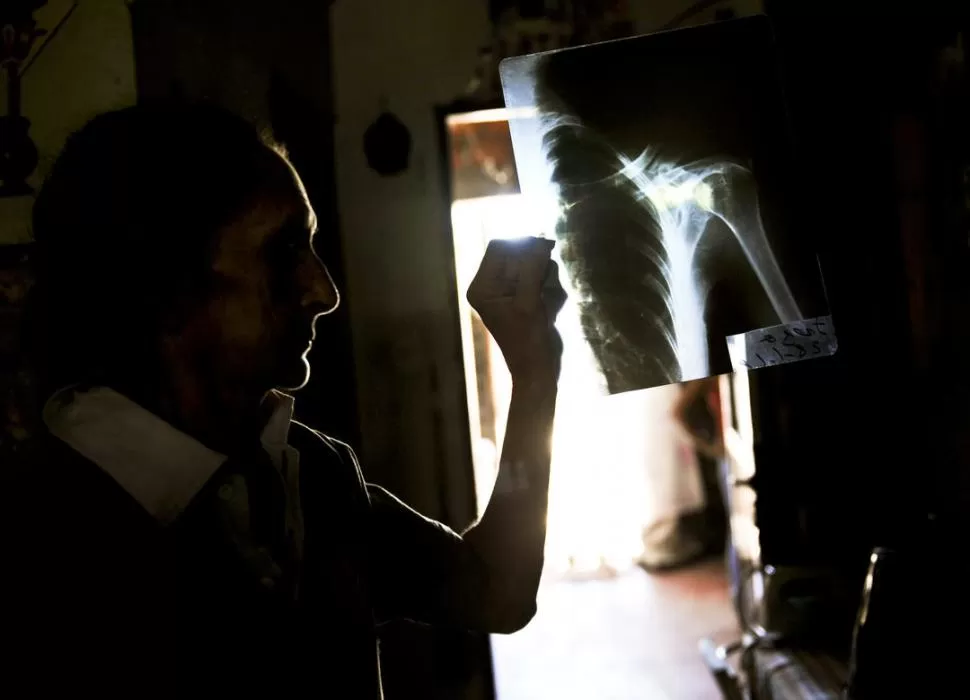 HUELLAS. Yolanda muestra la radiografía donde se nota la fractura de clavícula que le provocó la golpiza que le propinó su pareja. la gaceta / foto de Jorge Olmos Sgrosso