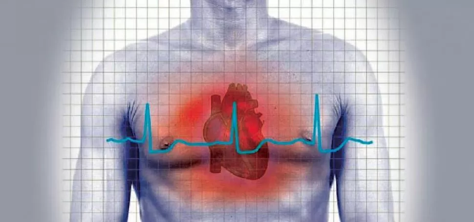 ¡ATENCIÓN! Si tenés dolor repentino en el centro del pecho, sufrís lipotimia o un síncope, andá al cardiólogo. monograficos.elperiodico.com