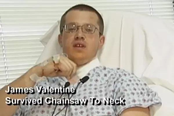 Hombre sobrevive milagrosamente luego de enterrar una sierra eléctrica en su cuello