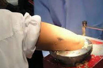 La sierra le destruyó la mano a un carnicero