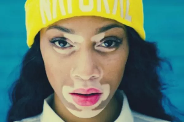 Una modelo con vitiligo triunfa en las pasarelas