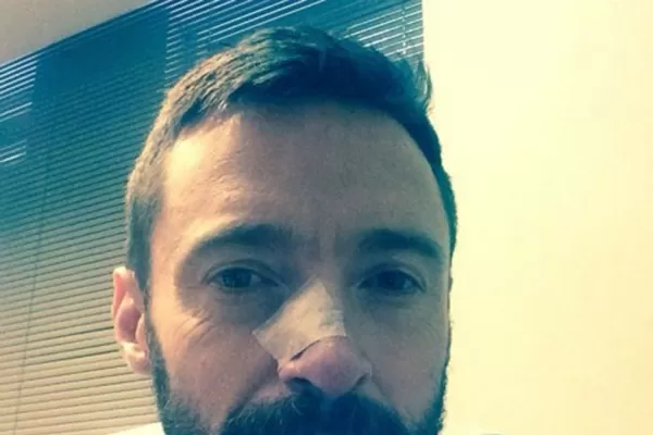 El actor Hugh Jackman, operado de nuevo por un cáncer de piel