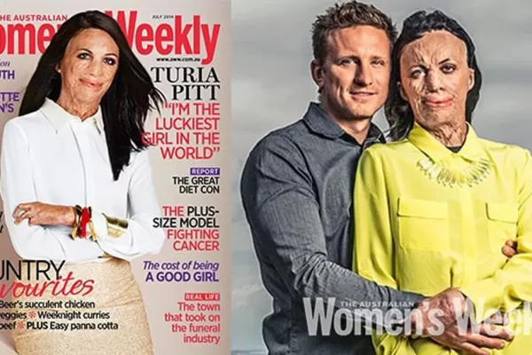 Sobrevivió a un incendio y ahora es tapa de una prestigiosa revista de modas