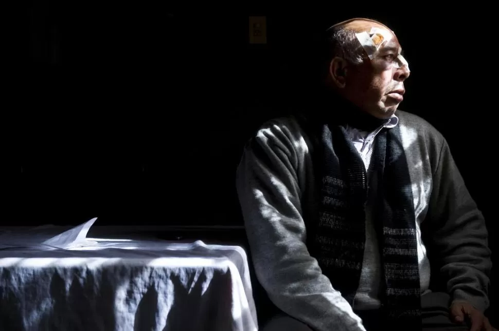 SIGNOS DEL VIOLENTO EPISODIO. El concejal Barros recibió a LA GACETA en su casa. Apenas podía hablar por las heridas que tenía en la cara. la gaceta / foto de jorge olmos sgrosso