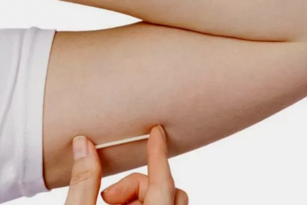 Lanzan un nuevo sistema de anticoncepción para adolescentes sin obra social