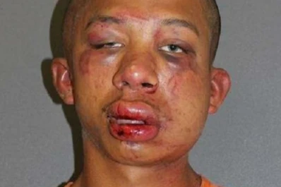 Padre desfiguró a un joven al ver que estaba abusando sexualmente de su hijo