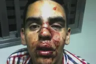 Denunció que tres policías lo golpearon en un boliche del microcentro