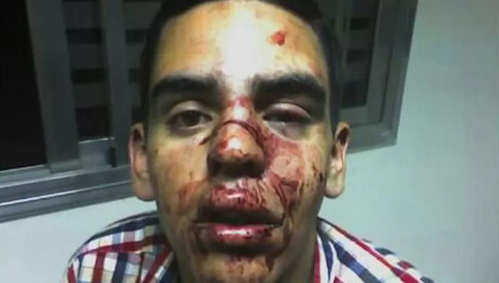 Denunció que tres policías lo golpearon en un boliche del microcentro