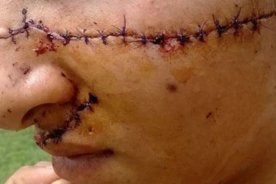 Desfiguran a una chica por linda: ahora vas a quedar como Chucky