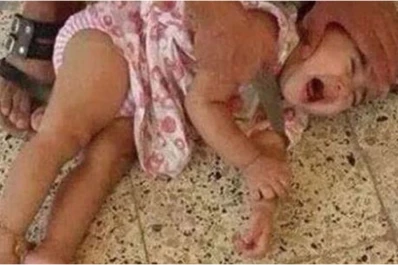Estremece al mundo la foto de una bebé con un cuchillo al cuello en Siria