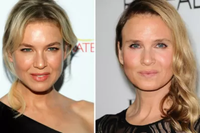 El irreconocible rostro de la actriz Renée Zellweger