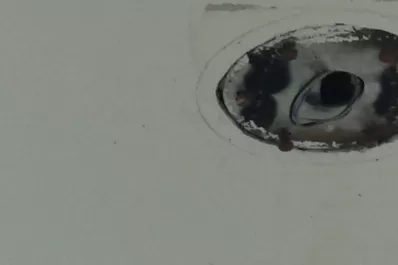 Techos del hospital Padilla en pésimo estado