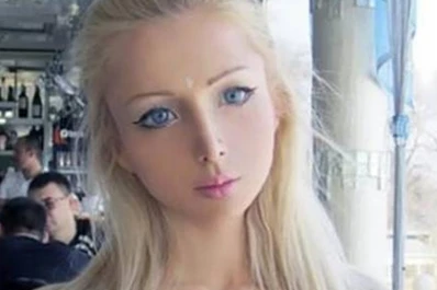 La Barbie humana recibió una feroz golpiza y quedó desfigurada